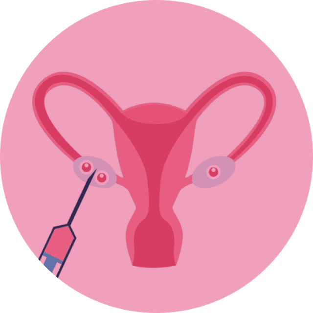 Ovum Pickup