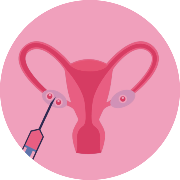 Ovum Pickup